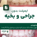 ایمپلنت بدون جراحی و بخیه