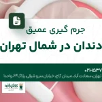 جرمگیری عمیق دندان در شمال تهران