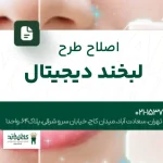 اصلاح طرح لبخند دیجیتال