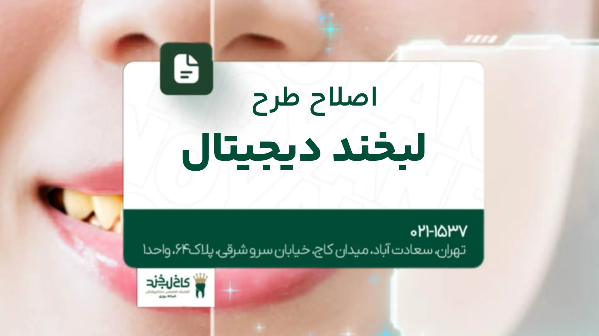 اصلاح طرح لبخند دیجیتال