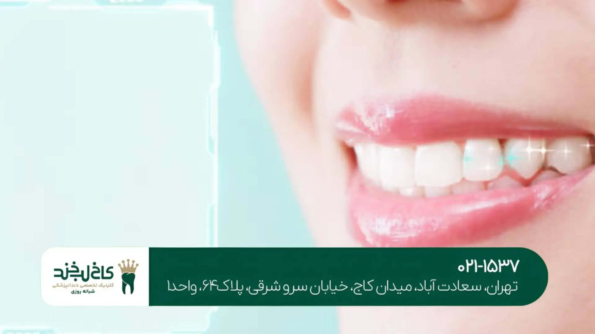 اصلاح طرح لبخند دیجیتال