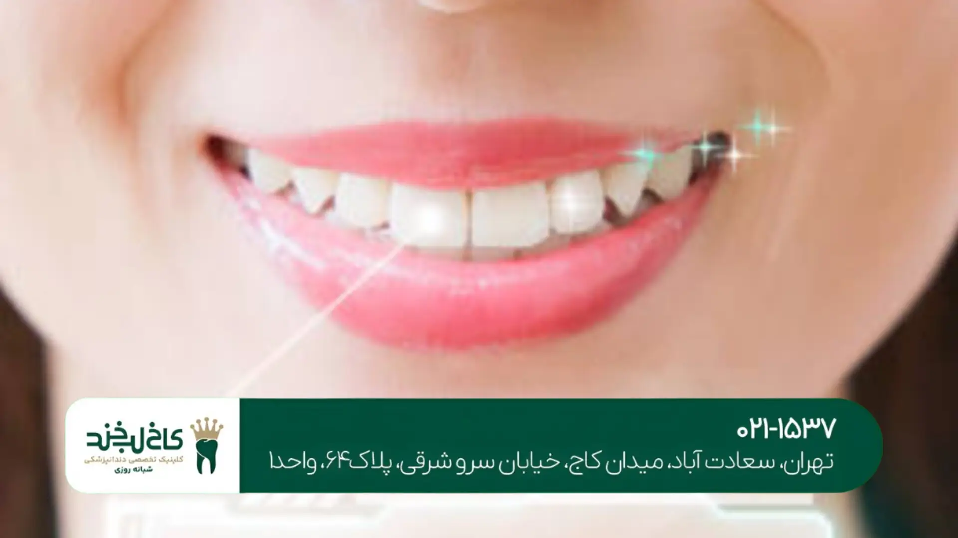 اصلاح طرح لبخند دیجیتال