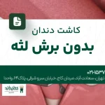 کاشت دندان بدون برش لثه