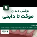 روکش دندان موقت تا دایمی