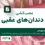 عصب‌کشی دندان‌های عقبی