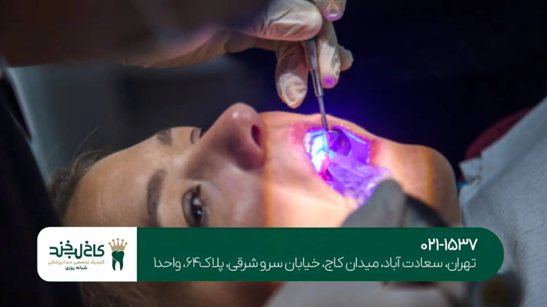 درمان التهاب لثه با لیزر