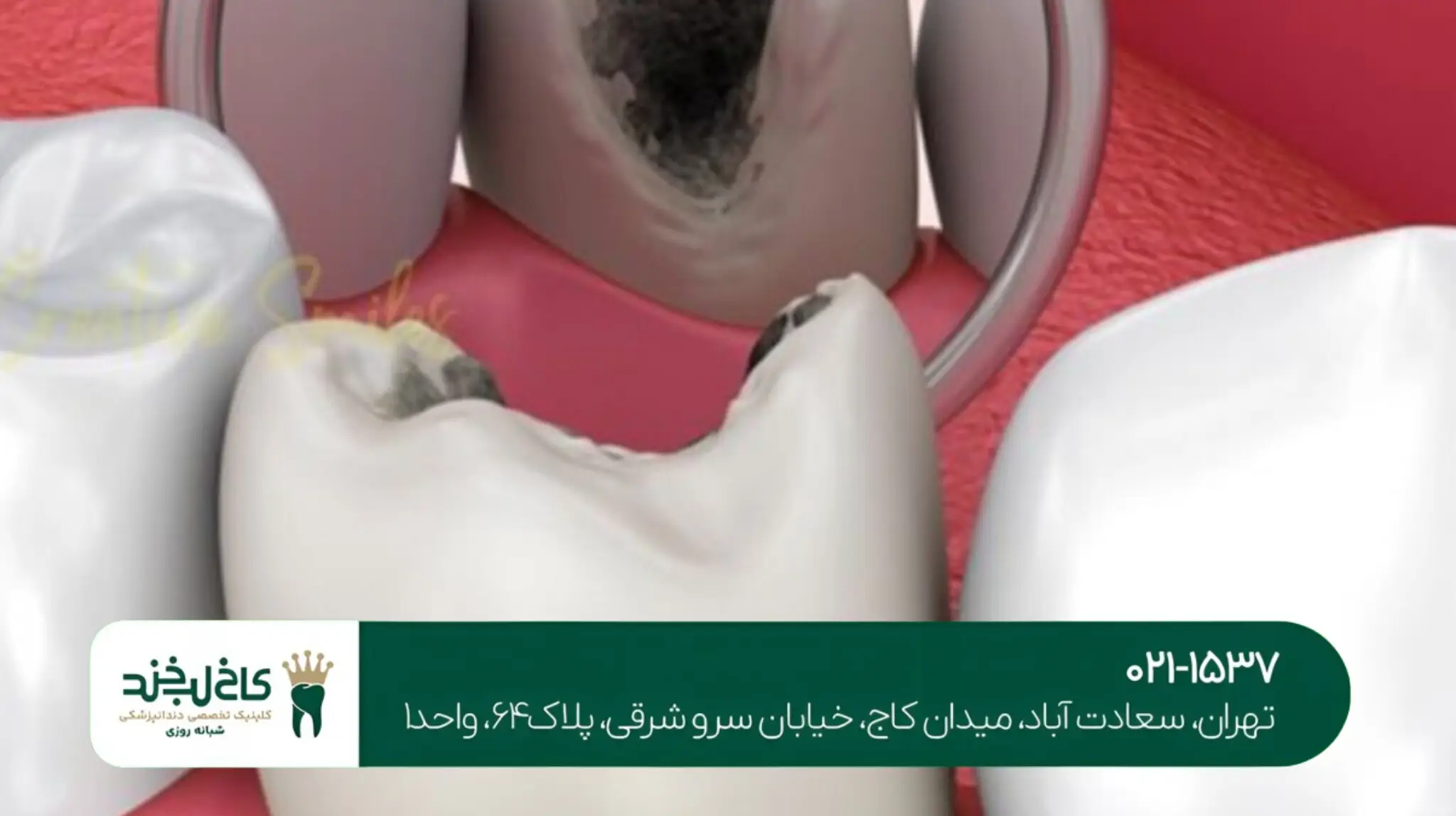 کلینیک تخصصی درمان ریشه دندان