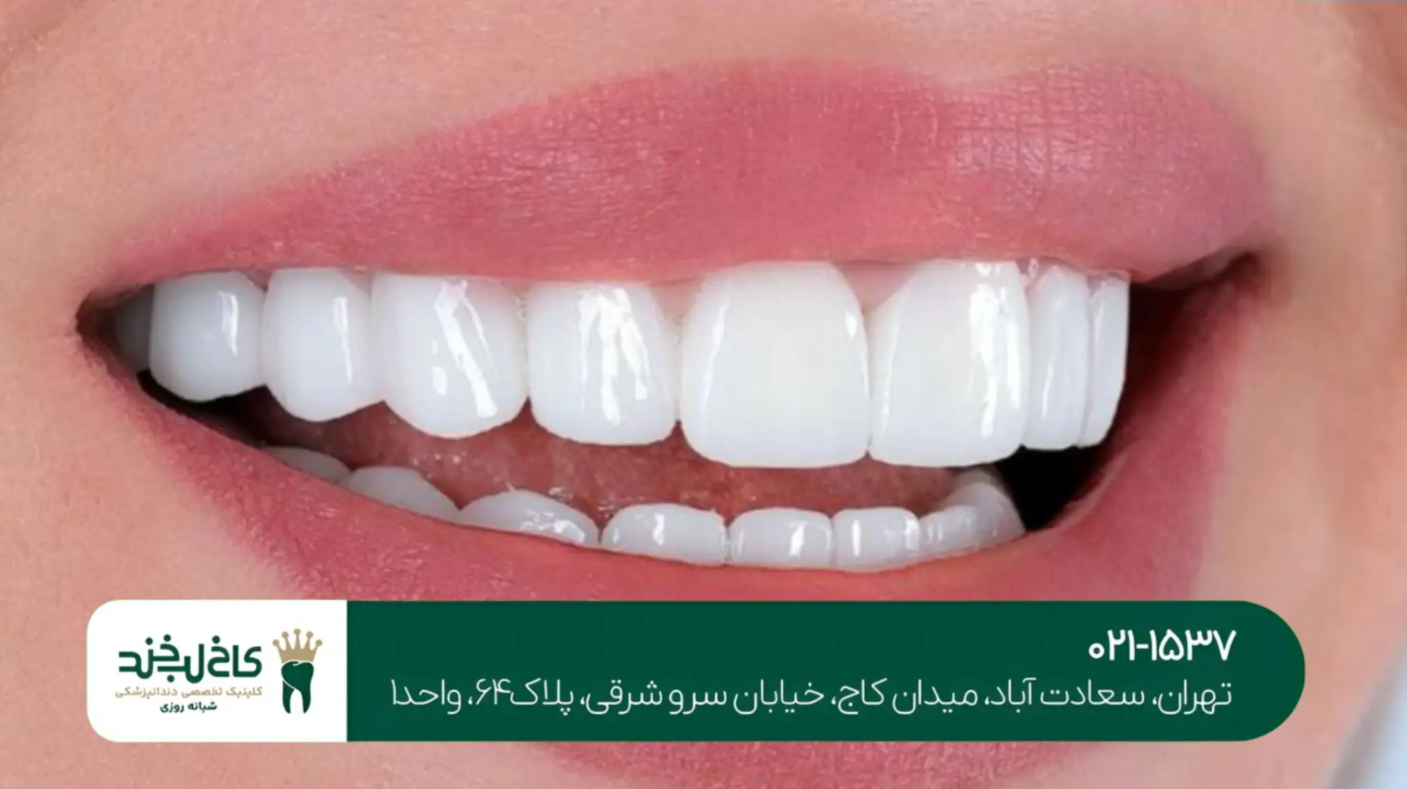 بهترین دندانپزشکی شبانهروزی شمال تهران