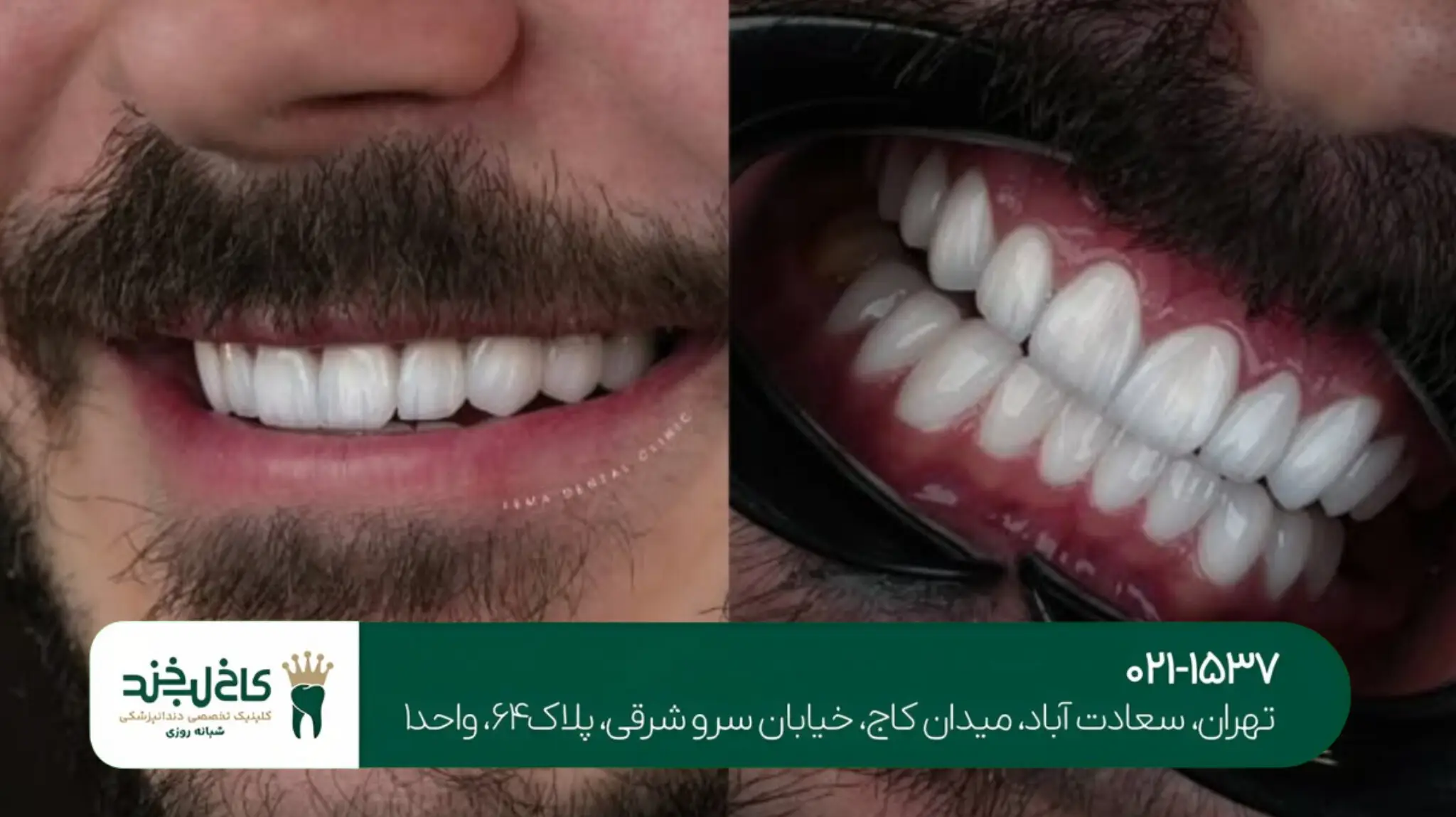 بهترین دندانپزشکی شبانهروزی شمال تهران