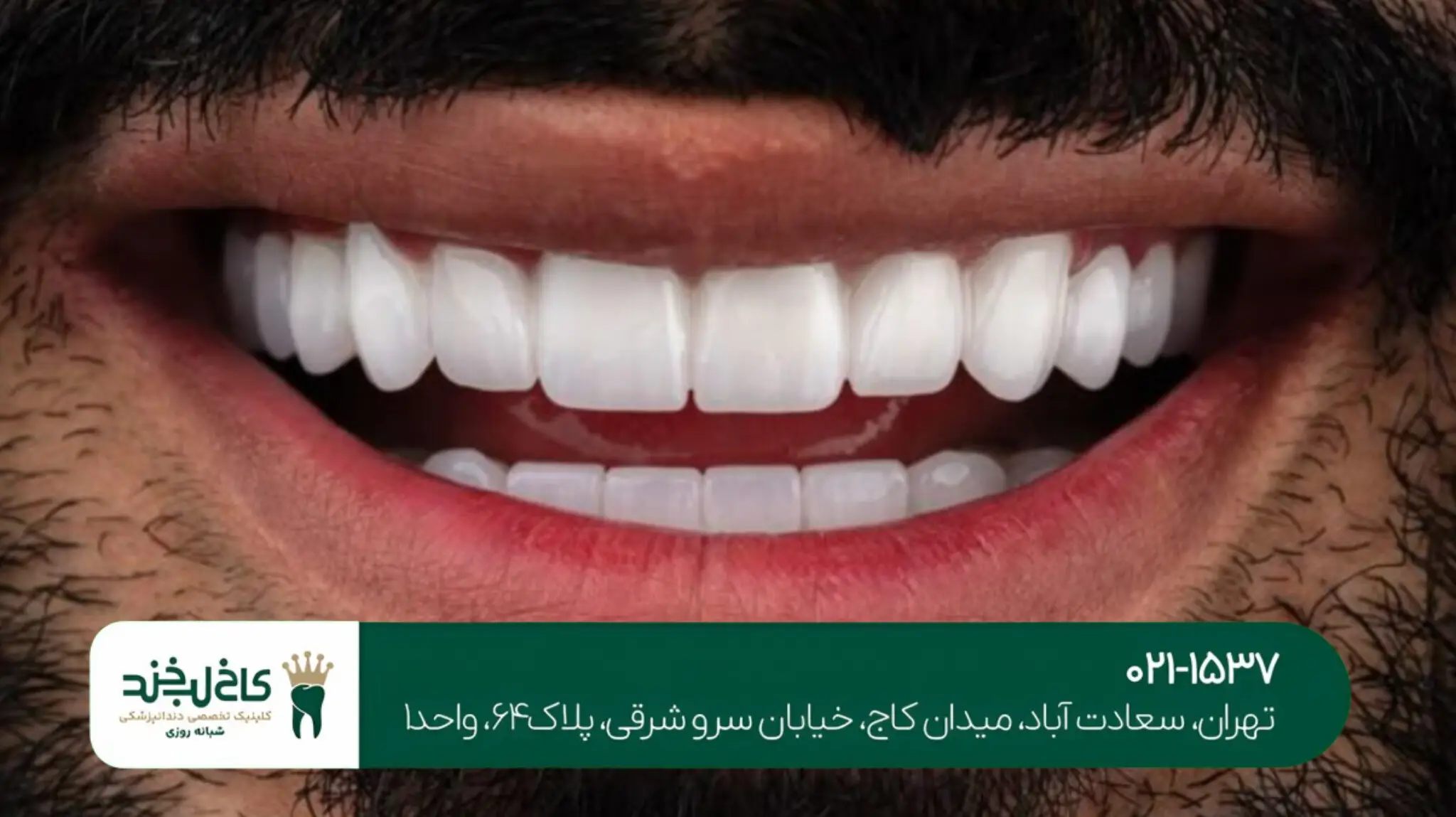 بهترین دندانپزشکی شبانهروزی شمال تهران