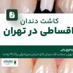 کاشت دندان اقساطی در تهران