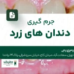 جرمگیری دندانهای زرد