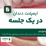 ایمپلنت دندان در یک جلسه