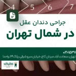 جراحی دندان عقل در شمال تهران