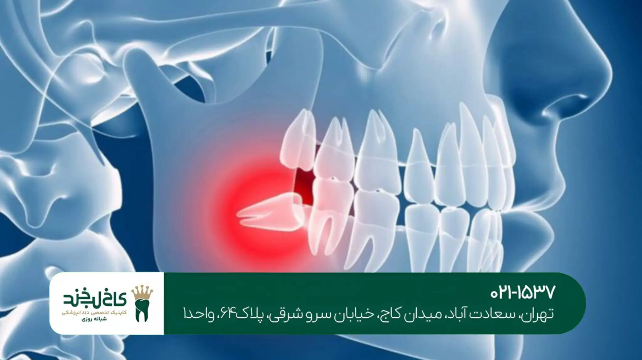 بهترین دندانپزشک کاشت ایمپلنت