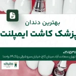 بهترین دندانپزشک کاشت ایمپلنت