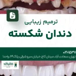 ترمیم زیبایی دندان شکسته