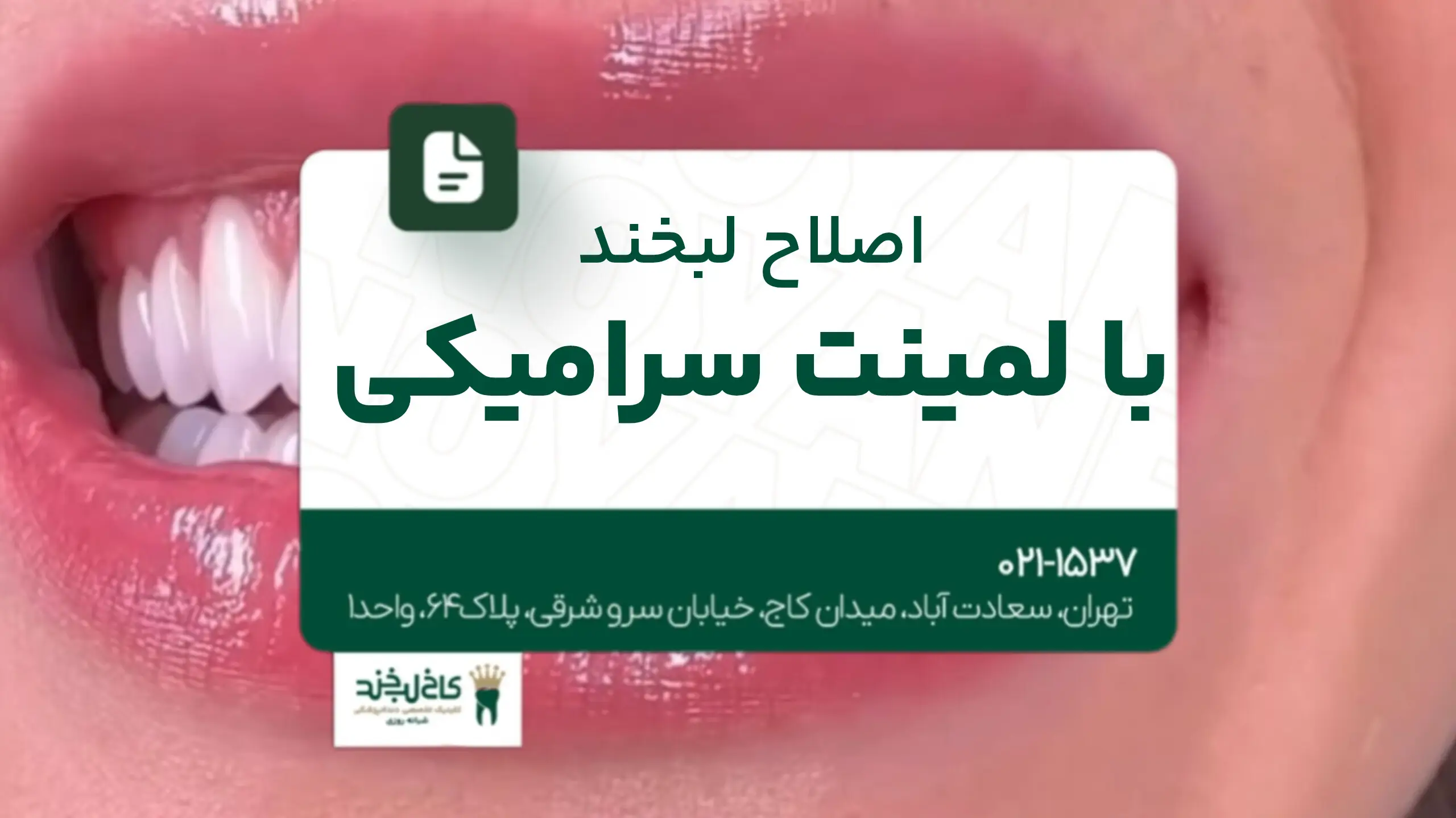 اصلاح لبخند با لمینت سرامیکی 
