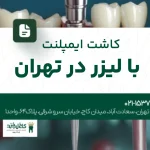 کاشت ایمپلنت با لیزر در تهران