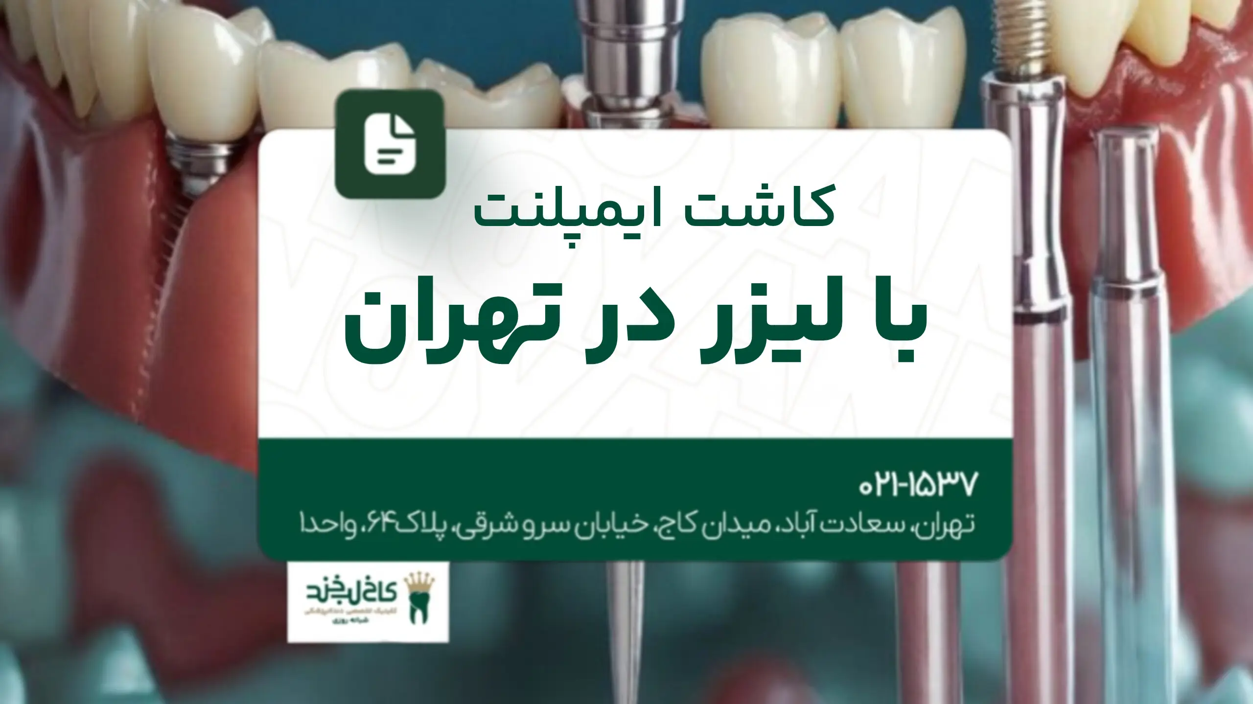 کاشت ایمپلنت با لیزر در تهران