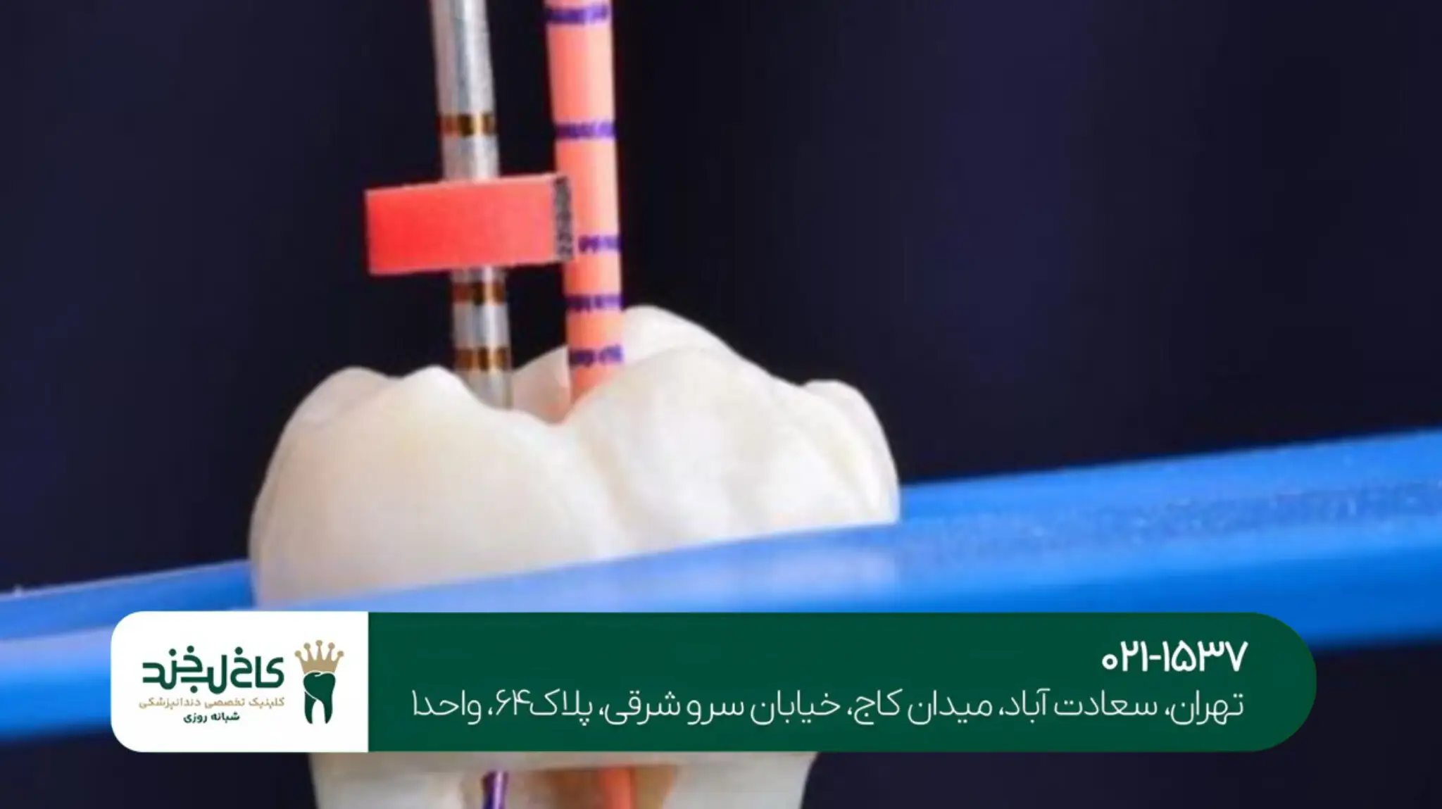 کاشت ایمپلنت با لیزر در تهران