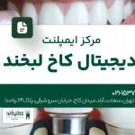 مرکز ایمپلنت دیجیتال کاخ لبخند
