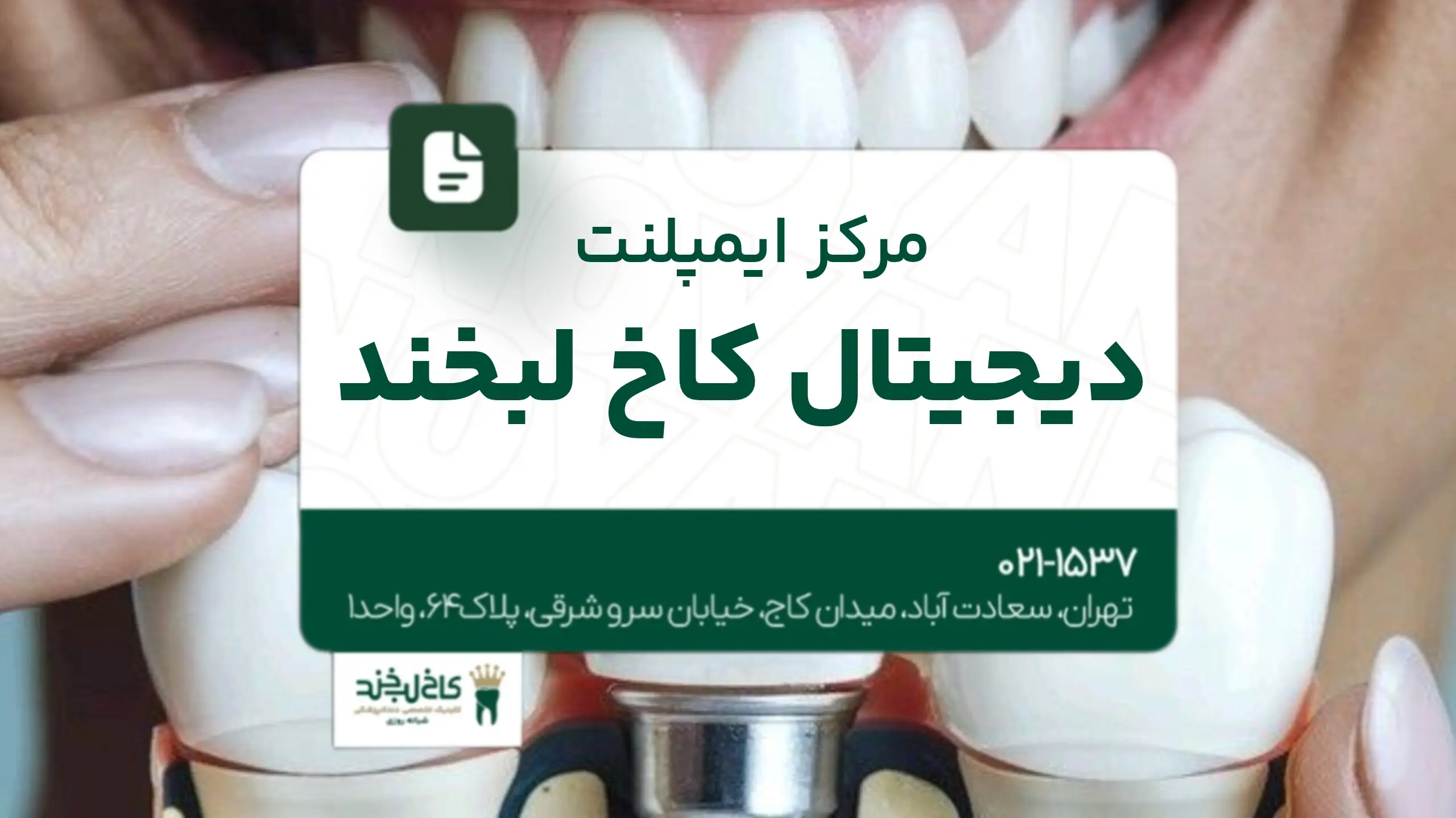 مرکز ایمپلنت دیجیتال کاخ لبخند