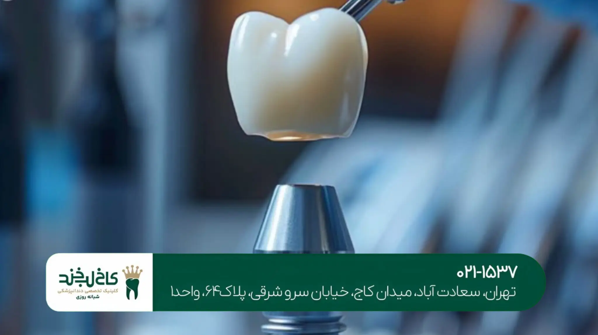 مرکز ایمپلنت دیجیتال کاخ لبخند