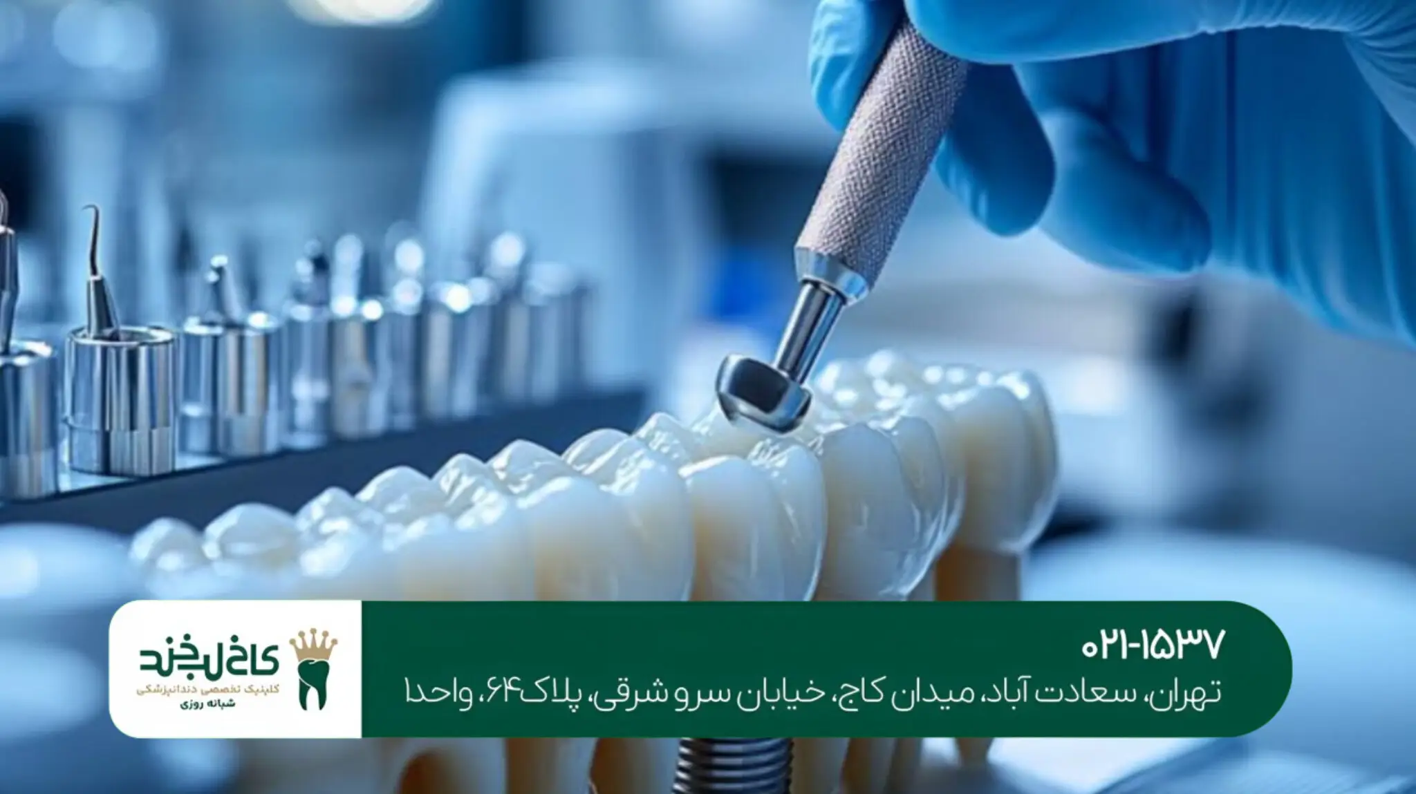 مرکز ایمپلنت دیجیتال کاخ لبخند