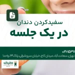 سفید کردن دندان در یک جلسه