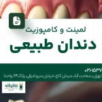 لمینت و کامپوزیت دندان طبیعی