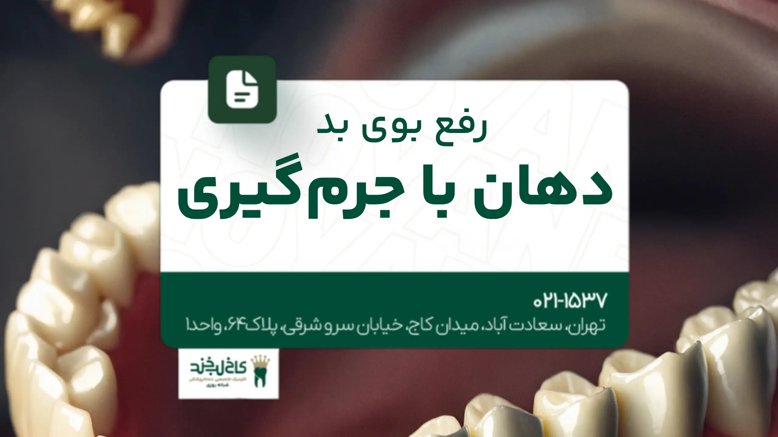 رفع بوی بد دهان با جرم‌گیری