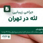 جراحی زیبایی لثه در تهران