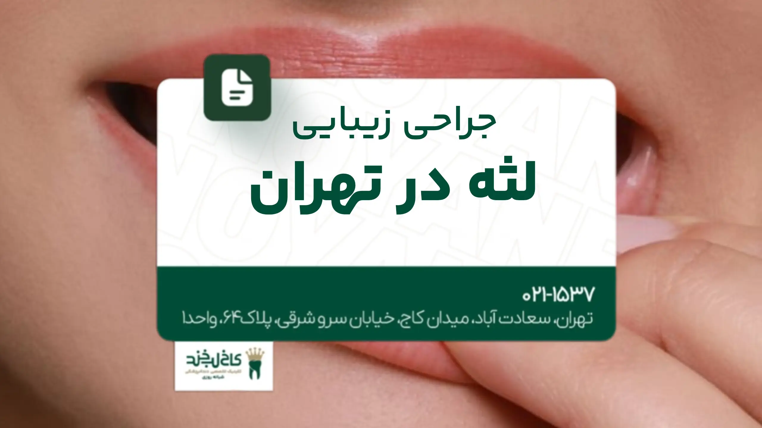 جراحی زیبایی لثه در تهران