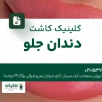 کلینیک کاشت دندان جلو