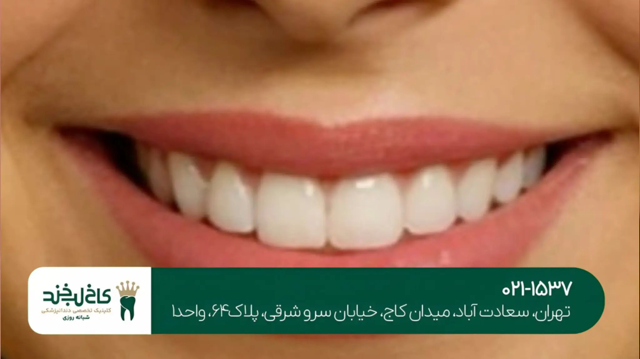 طراحی لبخند دیجیتال با کامپیوتر