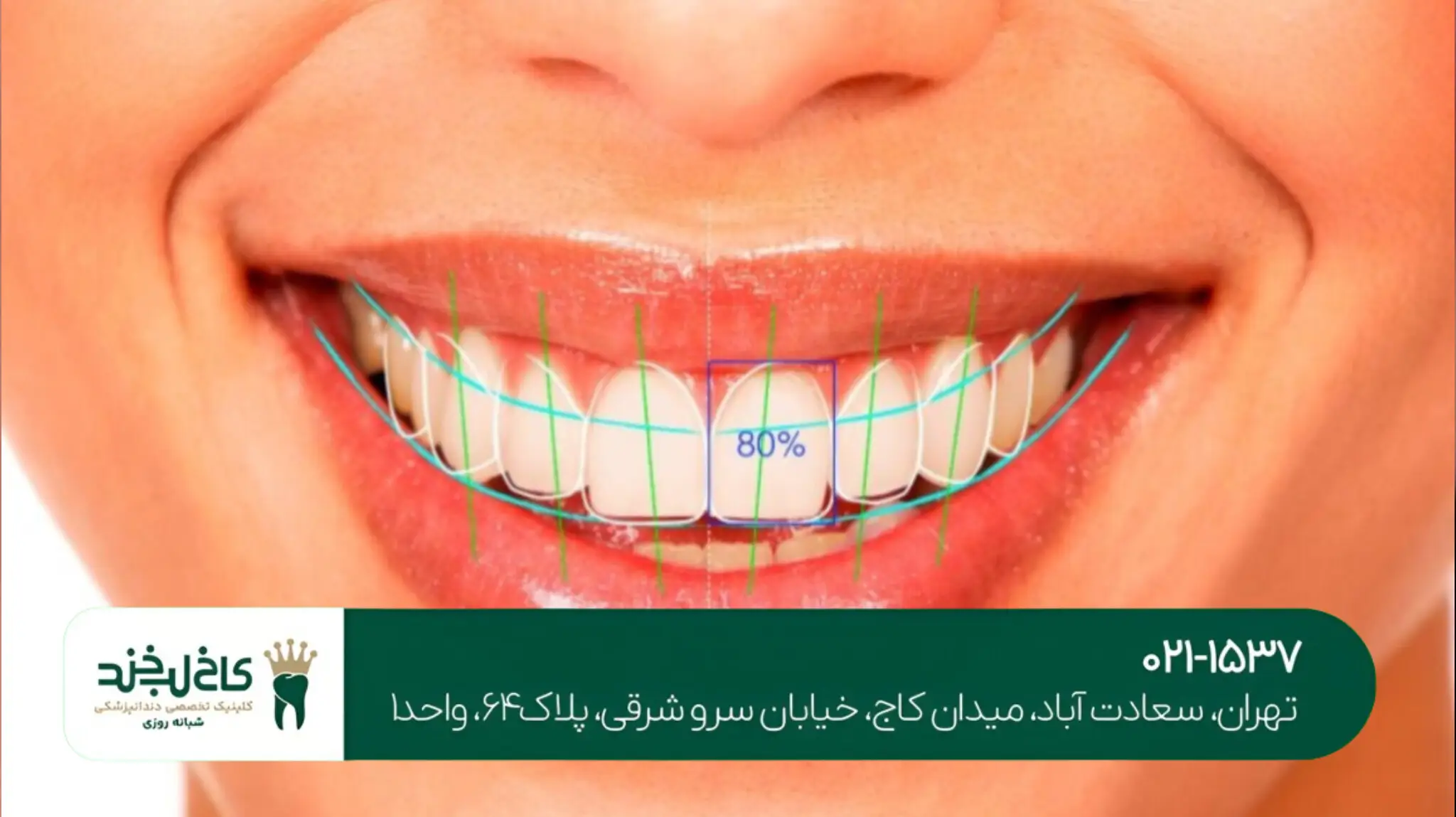 بهترین کلینیک دندانپزشکی غرب تهران