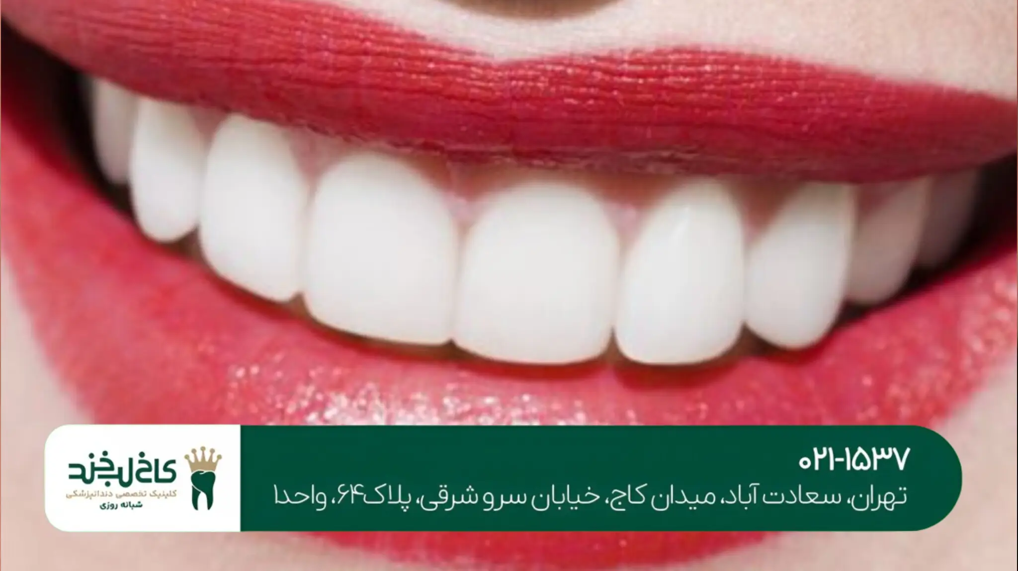 بهترین کلینیک دندانپزشکی غرب تهران