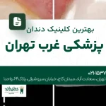 بهترین کلینیک دندانپزشکی غرب تهران