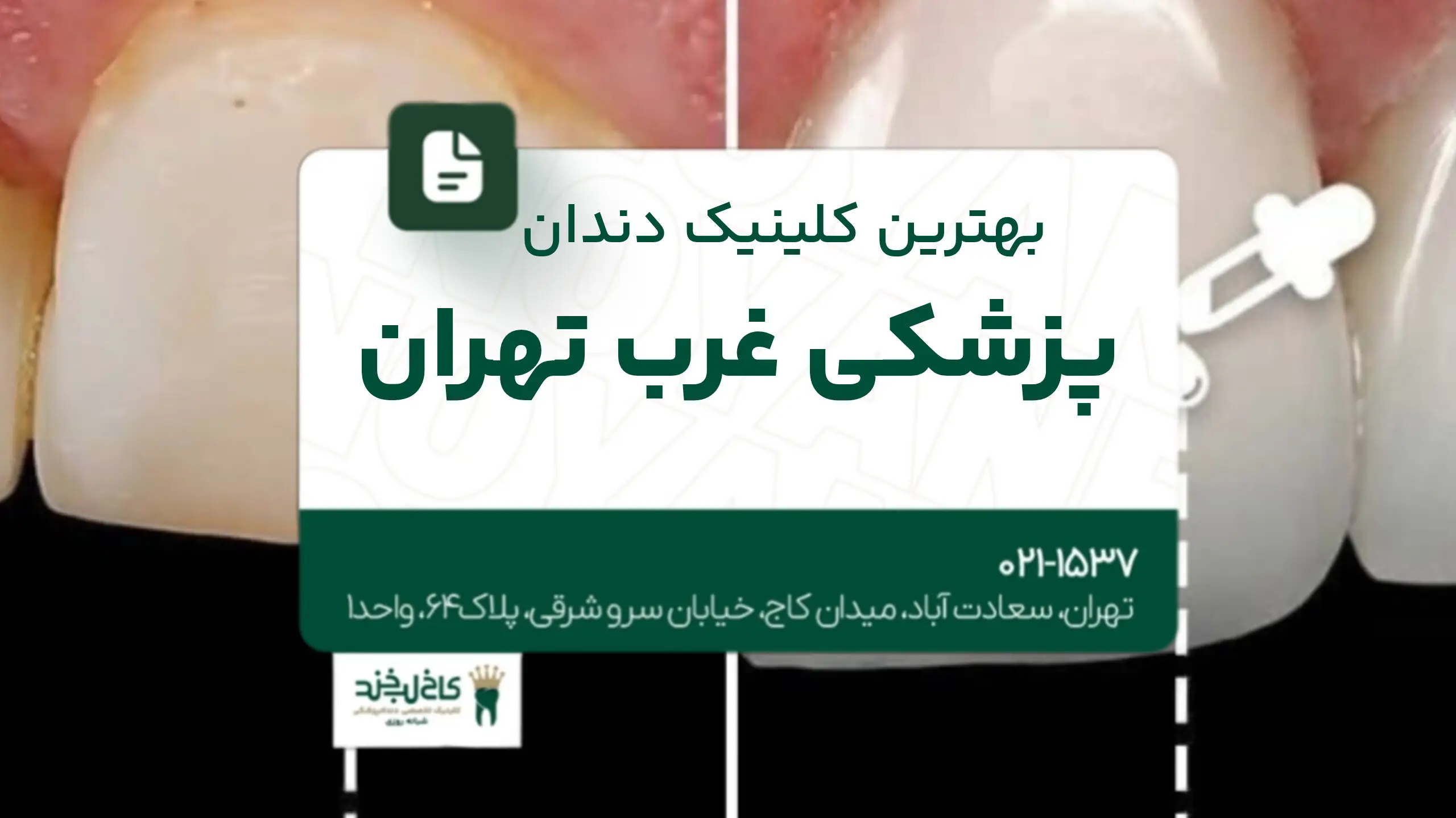 بهترین کلینیک دندانپزشکی غرب تهران