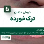 درمان دندان ترکخورده