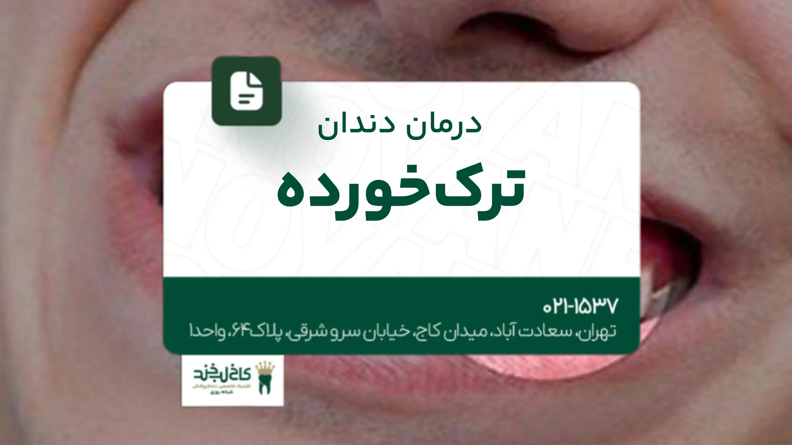 درمان دندان ترکخورده