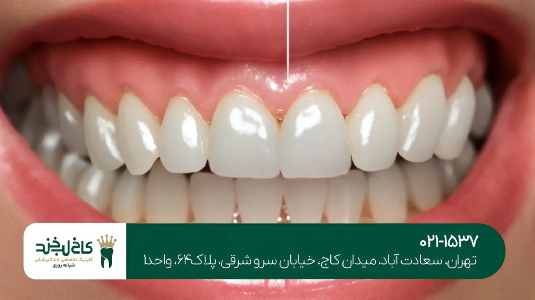 بهترین کلینیک دندانپزشکی غرب تهران