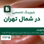 بلیچینگ تخصصی در شمال تهران