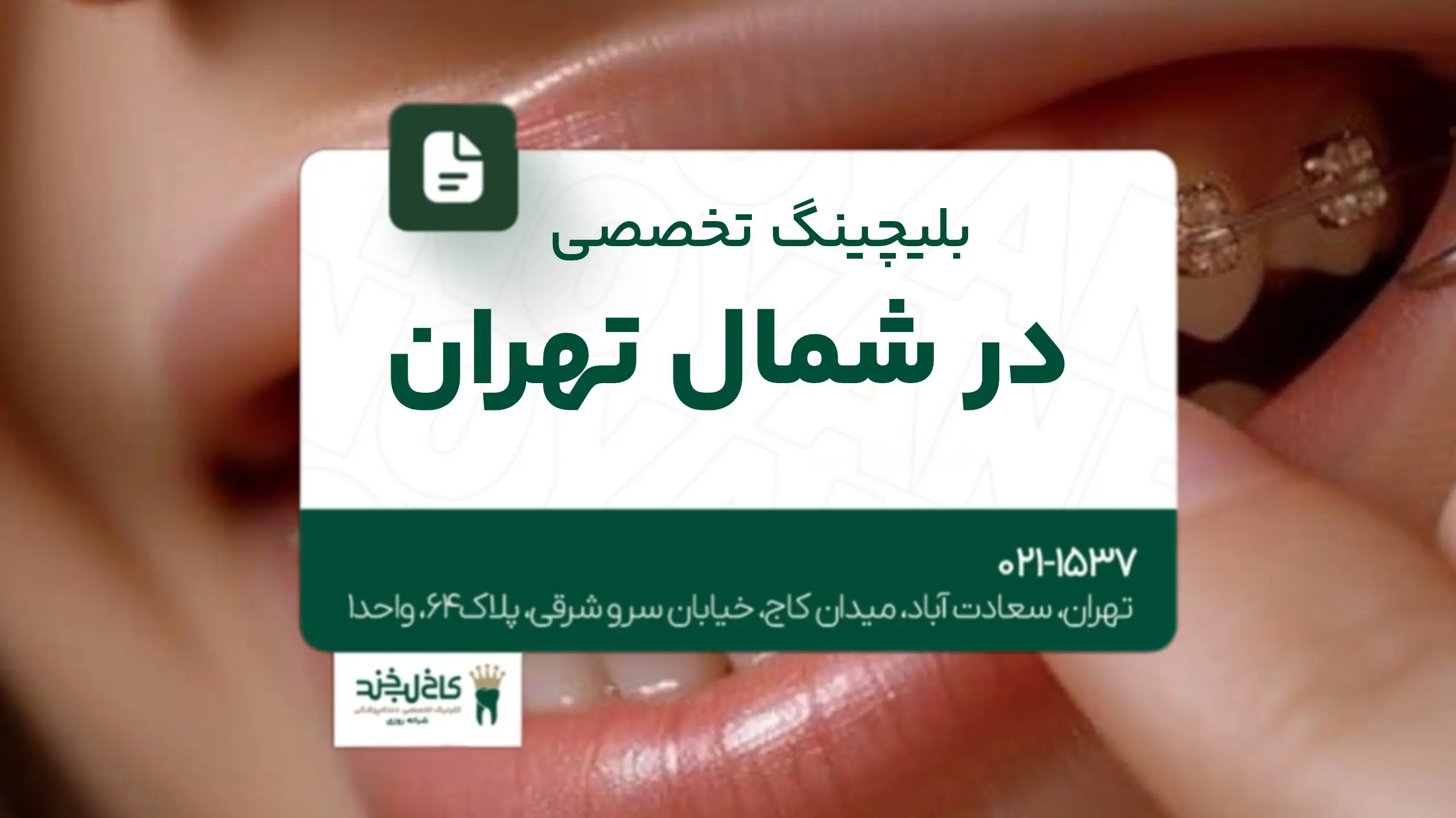 بلیچینگ تخصصی در شمال تهران