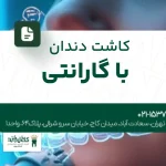 کاشت دندان با گارانتی