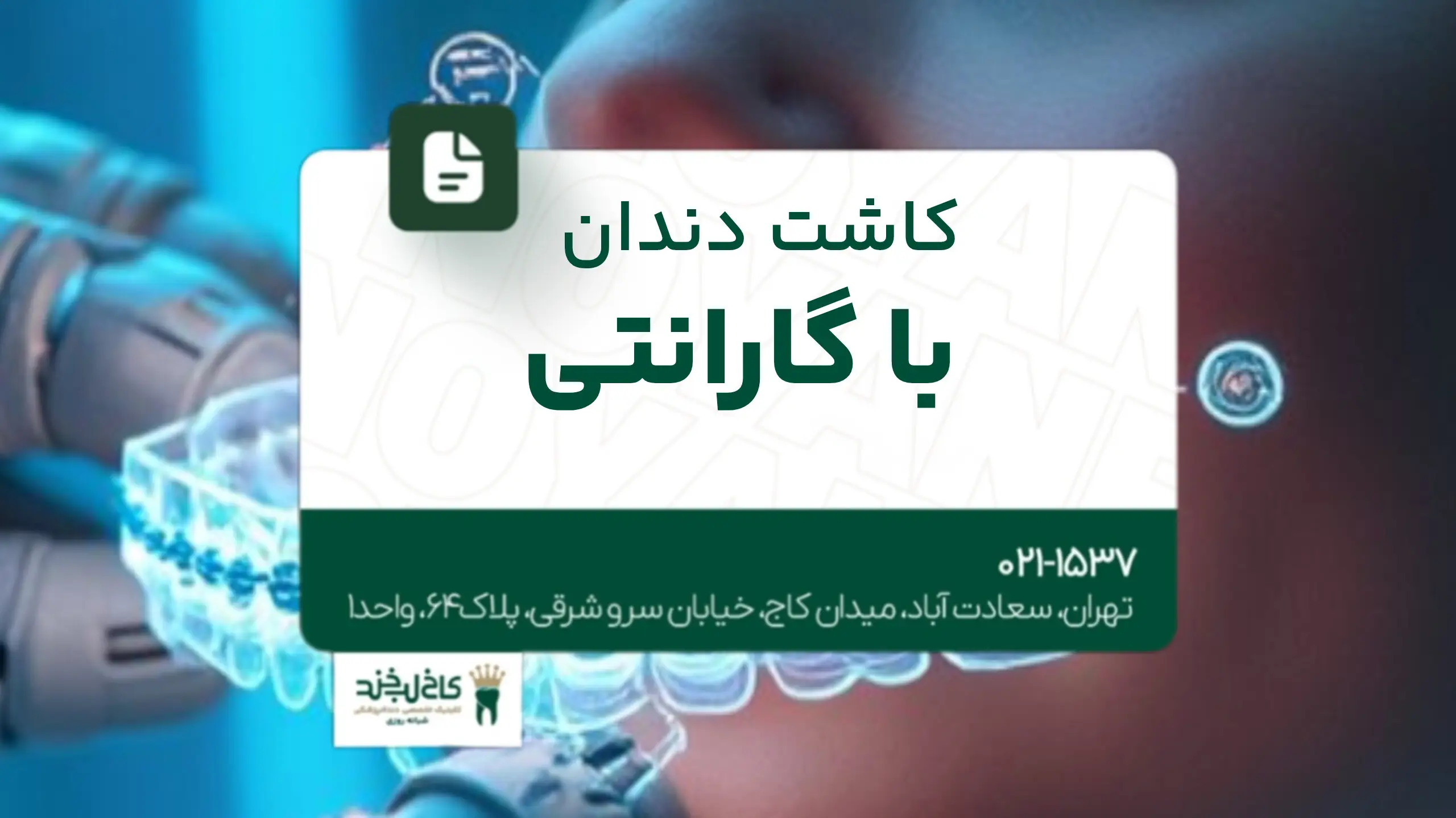 کاشت دندان با گارانتی