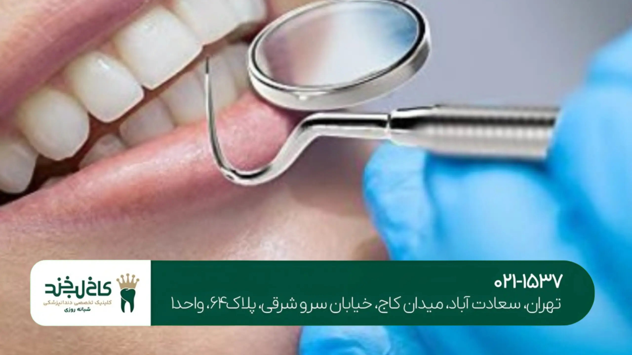 کاشت دندان با گارانتی