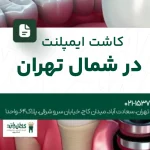 کاشت ایمپلنت در شمال تهران