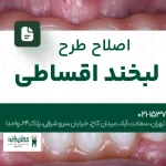 اصلاح طرح لبخند اقساطی